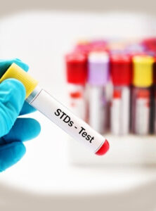 STD Testing
